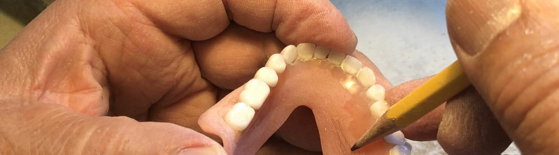 Top 10 Denture Adhesives